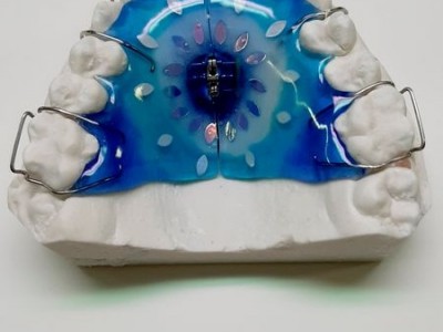 Niebieska nakładka na zęby